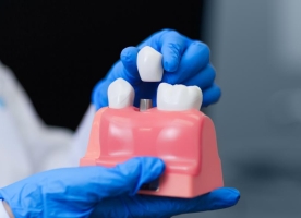 降价后的种植牙服务将于3月下旬到4月中旬落地实施