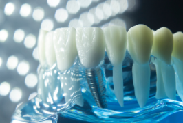 种牙告别万元时代 欧美品牌集采价遭腰斩