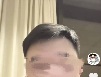 网红医生发视频称“女博士疑因洁牙感染梅毒”引争议，洁牙如何做到“零风险”？